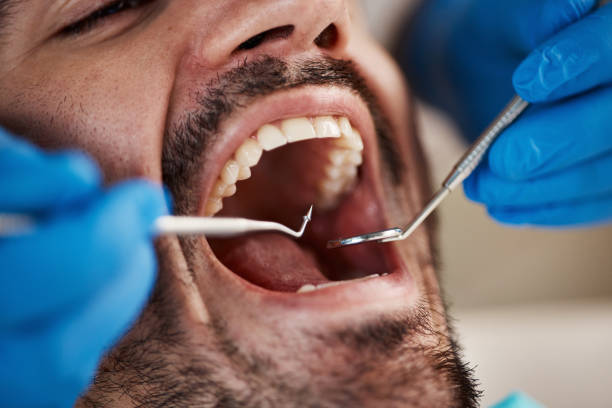 Best Emergency Dental Care for Broken or Chipped Teeth in Lyndhurst, VA