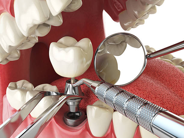 Best Pediatric Emergency Dentist in Lyndhurst, VA
